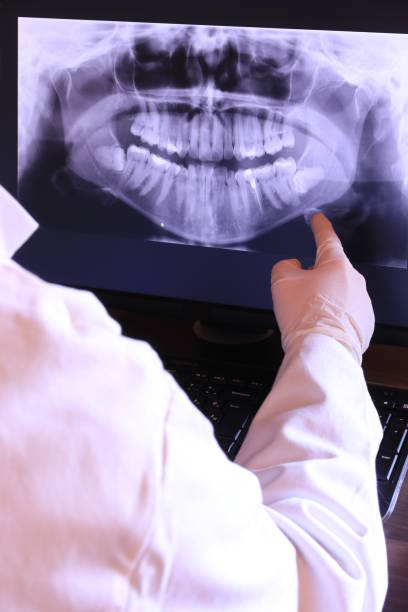 Best Emergency Denture Repair in Ilco, WA